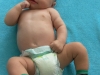 5 miesięczne niemowlę z asymetrią posturalną imitującą kręcz szyi