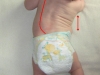 asymetria posturalna u niemowlaka