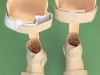 Zaopatrzenie ortopedyczne zastosowane u dziecka z MPD